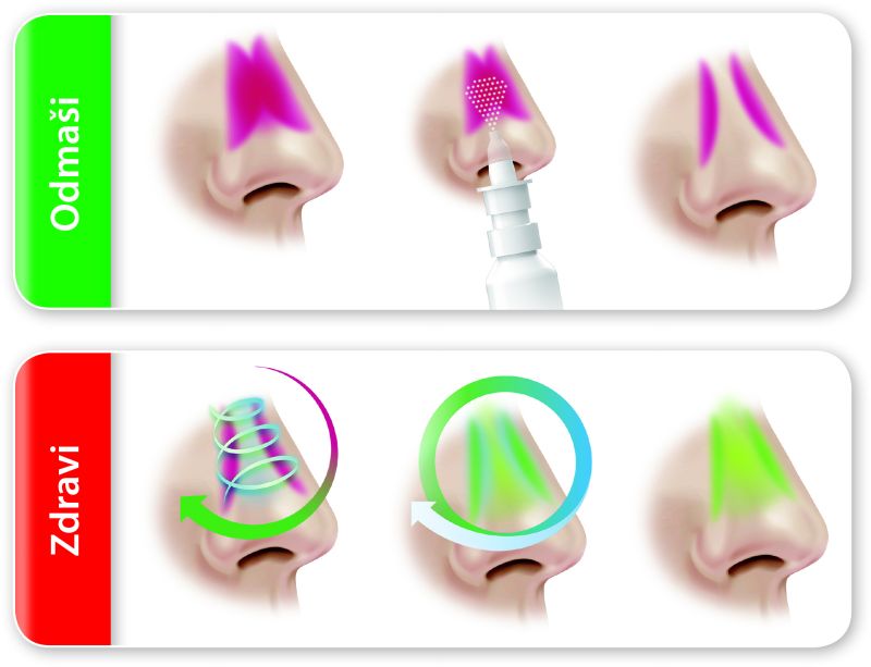 Septonazal - odmaši in zdravi.